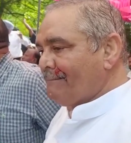 भाजपा-बसपा वर्करों में हाथापाई, पूर्व केंद्रीय मंत्री विजय सांपला हुए लहूलुहान… वीडियो देखें भाजपा-बसपा वर्करों में हाथापाई, पूर्व केंद्रीय मंत्री विजय सांपला हुए लहूलुहान… वीडियो देखें